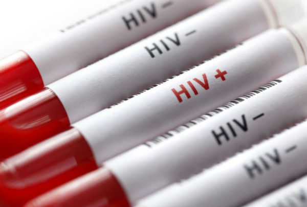 nhiễm hiv không điều trị sống được bao lâu 1