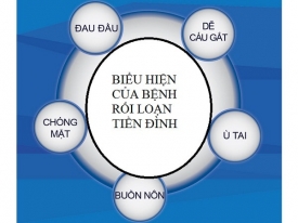 7 biểu hiện thường gặp của bệnh rối loạn tiền đình